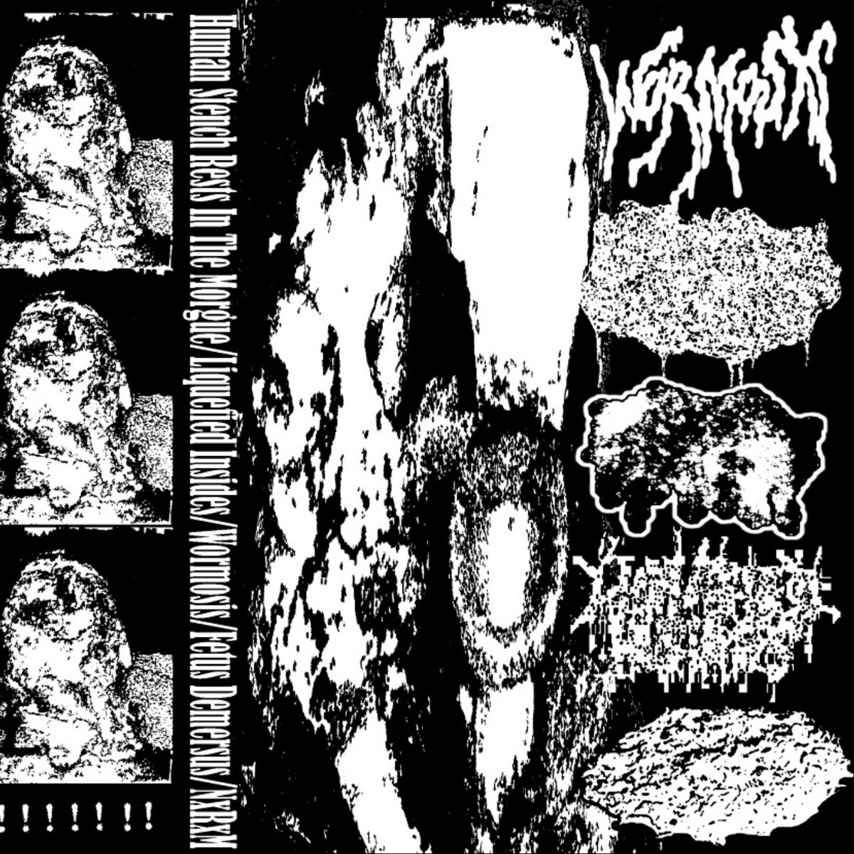 Human Stench Rests In The Morgue / Liquified Insides / Wormosis / Fetus Demersus / Nosocomial Renal Myiasis - Split CDr